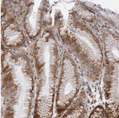 Immunohistochemistry-Paraffin GCSAML Antibody - BSA Free