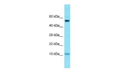 Western Blot: GCSAML Antibody [NBP2-84961] - Host: Rabbit. Target Name: GCSAML. Sample Type: Placenta lysates. Antibody Dilution: 1.0ug/ml