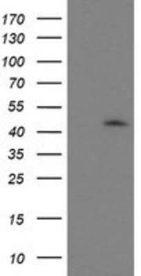 Western Blot: GDAP1L1 Antibody (1G5) [NBP2-00946] - HEK293T cells were transfected with the pCMV6-ENTRY control (Left lane) or pCMV6-ENTRY GDAP1L1 (Right lane) cDNA for 48 hrs and lysed. Equivalent amounts of cell lysates (5 ug per lane) were separated by SDS-PAGE and immunoblotted with anti-GDAP1L1.