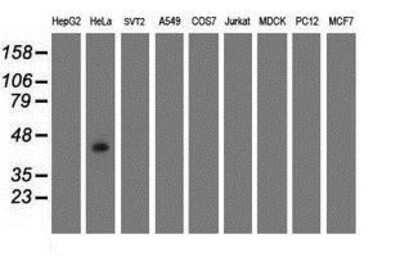 Western Blot: GDAP1L1 Antibody (1G5) [NBP2-00946] Analysis of extracts (35ug) from 9 different cell lines by using anti-GDAP1L1 monoclonal antibody.