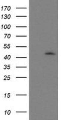 Western Blot: GDAP1L1 Antibody (OTI1G5) - Azide and BSA Free [NBP2-72182] - HEK293T cells were transfected with the pCMV6-ENTRY control (Left lane) or pCMV6-ENTRY GDAP1L1 (Right lane) cDNA for 48 hrs and lysed. Equivalent amounts of cell lysates (5 ug per lane) were separated by SDS-PAGE and immunoblotted with anti-GDAP1L1.