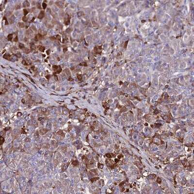 Immunohistochemistry-Paraffin: GDC Antibody [NBP1-91933] - Staining of human pancreas shows distinct cytoplasmic positivity in exocrine glandular cells.