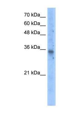 Western Blot: GDC Antibody [NBP1-59587] - Transfected 293T cell lysate, concentration 5.0ug/ml.