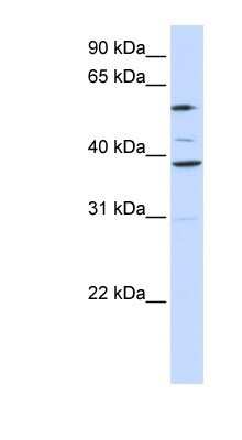 Western Blot: GDC Antibody [NBP1-59588] - 721_B cell lysate, concentration 0.2-1 ug/ml.