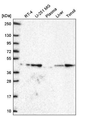 Western Blot: GDF-11/BMP-11 Antibody [NBP2-57399] - Analysis in human cell line RT-4, human cell line U-251 MG, human plasma, human liver tissue and human tonsil tissue.