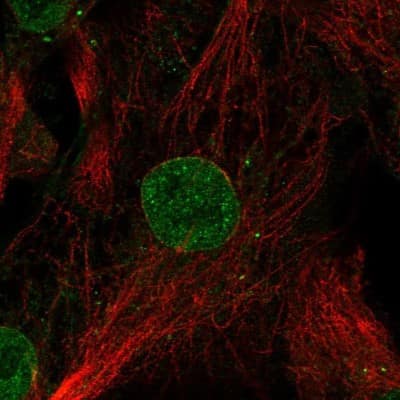 Immunocytochemistry/ Immunofluorescence GDF-6/BMP-13 Antibody