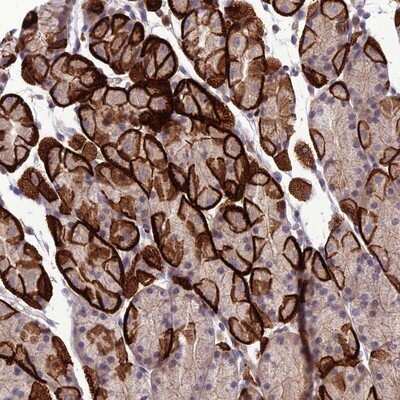 Immunohistochemistry-Paraffin: GDF-6/BMP-13 Antibody [NBP1-91934] - Staining of human stomach, lower shows strong membranous and cytoplasmic positivity in glandular cells.