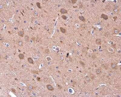 Immunohistochemistry-Paraffin GDF-6/BMP-13 Antibody