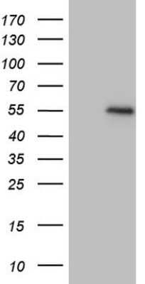 Western Blot: GDF-8/Myostatin Antibody (7H5) [NBP2-46025] - Analysis of HEK293T cells were transfected with the pCMV6-ENTRY control (Left lane) or pCMV6-ENTRY GDF-8.