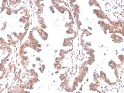 Immunohistochemistry-Paraffin: GDF-9 Antibody (GDF9/4261) - Azide and BSA Free [NBP3-08362] - Formalin-fixed, paraffin-embedded human ovary stained with GDF-9 Mouse Monoclonal Antibody (GDF-9/4261).