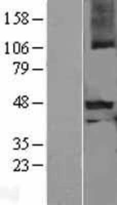 Western Blot: GDF8/Myostatin Overexpression Lysate (Adult Normal) [NBL1-13340] Left-Empty vector transfected control cell lysate (HEK293 cell lysate); Right -Over-expression Lysate for GDF8/Myostatin.