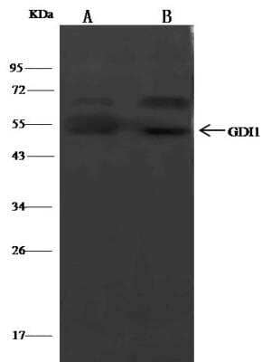 Immunoprecipitation: GDI1 Antibody [NBP2-99205] - Lane A:0.5 mg Hela Whole Cell LysateLane B:0.5 mg U87MG Whole Cell Lysate2 uL anti-GDI1 rabbit polyclonal antibody and 15 ul of 50 % Protein G agarose.Primary antibody:Anti-GDI1 rabbit polyclonal antibody,at 1:100 dilution Secondary antibody:Clean-Bloto IP Detection Reagent (HRP) at 1:500 dilutionDeveloped using the DAB staining technique.Performed under reducing conditions.Predicted band size: 49 kDaObserved band size: 49 kDa