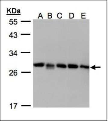 Western Blot: GDI2 Antibody [NBP1-52317] - Sample(30g whole cell lysate). A: 293T. B: A431. C: H1299. D: HeLa S3. E: Hep G2. 12% SDS PAGE. GDI2 antibody diluted at 1:1000