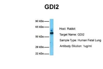 Western Blot: GDI2 Antibody [NBP2-84039] - Host: Rabbit. Target Name: GDI2. Sample Tissue: Human Fetal Lung. Antibody Dilution: 1.0ug/ml