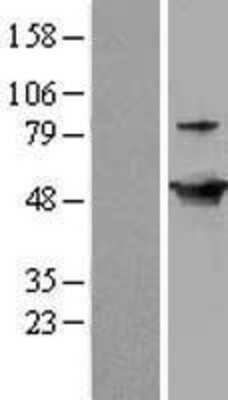 Western Blot: GDI2 Overexpression Lysate (Adult Normal) [NBL1-11030] Left-Empty vector transfected control cell lysate (HEK293 cell lysate); Right -Over-expression Lysate for GDI2.