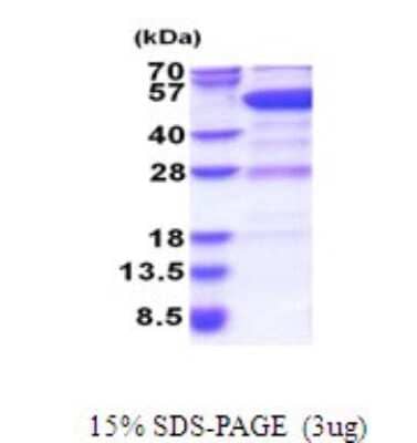 SDS-Page: GDI2 Recombinant Protein [NBP2-51667] - 15% SDS Page (3 ug)