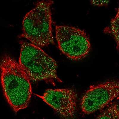 Immunocytochemistry/Immunofluorescence: GDNF Antibody [NBP2-56036] - Staining of human cell line U-251 MG shows localization to nucleoplasm & vesicles. Antibody staining is shown in green. 