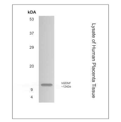 Western Blot: GDNF Antibody (MM0308-12F9) - Azide and BSA Free [NBP2-12335] -  Human placenta tissue lysate with NBP2-12335 mouse anti-human GDNF antibody.