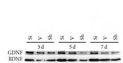 Western Blot: GDNF Antibody [H00002668-B01P] - GDNF in rat tissue with pAb dilution of 1:1000. This image was submitted via customer Review.