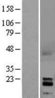 Western Blot: GDNF Overexpression Lysate (Adult Normal) [NBL1-11031] Left-Empty vector transfected control cell lysate (HEK293 cell lysate); Right -Over-expression Lysate for GDNF.