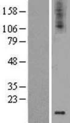 Western Blot GDNF Overexpression Lysate