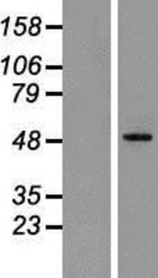 Western Blot: GDNF Receptor alpha 1 Overexpression Lysate (Adult Normal) [NBP2-10479] Left-Empty vector transfected control cell lysate (HEK293 cell lysate); Right -Over-expression Lysate for GDNF Receptor alpha 1.