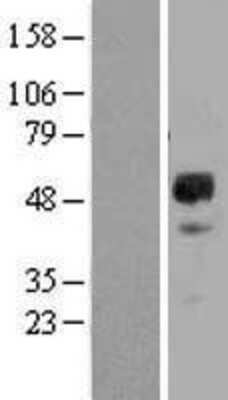 Western Blot: GDNF Receptor alpha 2 Overexpression Lysate (Adult Normal) [NBL1-11052] Left-Empty vector transfected control cell lysate (HEK293 cell lysate); Right -Over-expression Lysate for GDNF Receptor alpha 2.