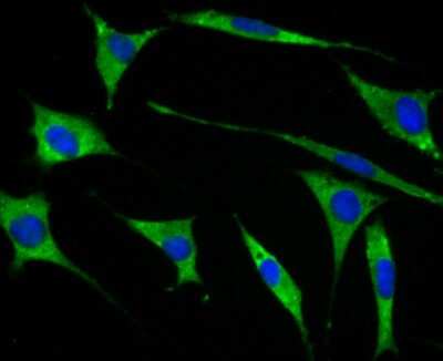 Immunocytochemistry/Immunofluorescence: GEF-H1 Antibody (JG36-46) [NBP2-76838] - ICC staining GEF H1 in SH-SY-5Y cells (green). The nuclear counter stain is DAPI (blue). Cells were fixed in paraformaldehyde, permeabilised with 0.25% Triton X100/PBS.