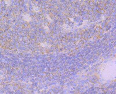 Immunohistochemistry: GEF-H1 Antibody (JG36-46) [NBP2-76838] - Immunohistochemical analysis of paraffin-embedded human tonsil tissue using anti-GEF H1 antibody. Counter stained with hematoxylin.
