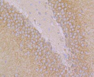 Immunohistochemistry: GEF-H1 Antibody (JG36-46) [NBP2-76838] - Immunohistochemical analysis of paraffin-embedded rat brain tissue using anti-GEF H1 antibody. Counter stained with hematoxylin.