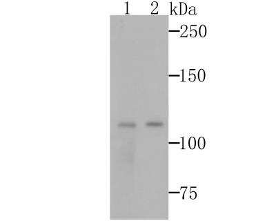 Western Blot: GEF-H1 Antibody (JG36-46) [NBP2-76838] - Western blot analysis of GEF H1 on 293T and A431 cells lysates using anti-GEF H1 antibody at 1/500 dilution.