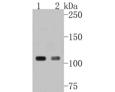 Western Blot: GEF-H1 Antibody (JG36-46) [NBP2-76838] - Western blot analysis of GEF-H1 on different lysates. Proteins were transferred to a PVDF membrane and blocked with 5% BSA in PBS for 1 hour at room temperature. The primary antibody (1/500) was used in 5% BSA at room temperature for 2 hours. Goat Anti-Rabbit IgG - HRP Secondary Antibody (HA1001) at 1:5,000 dilution was used for 1 hour at room temperature. Positive control: Lane 1: 293T cell lysate Lane 2: A431 cell lysate