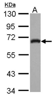 Western Blot: GEFT Antibody [NBP2-16636] - Sample (30 ug of whole cell lysate) A: IMR32 10% SDS PAGE gel, diluted at 1:1000.