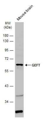 Western Blot: GEFT Antibody [NBP2-16636] - Mouse tissue extract (50 ug) was separated by 10% SDS-PAGE, and the membrane was blotted with GEFT antibody diluted at 1:1000. HRP-conjugated anti-rabbit IgG antibody was used to detect the primary antibody.