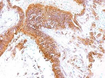 Immunohistochemistry-Paraffin: GEM Antibody [NBP1-30962] - Paraffin-embedded lung; antibody dilution 1:500.