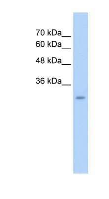 Western Blot: GEM Antibody [NBP1-58906] - HepG2 cell lysate. Antibody at 2.5 ug/mL.