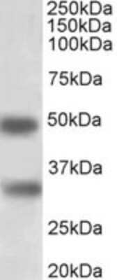 Western Blot: GEM Antibody [NBP2-26121] - (1ug/ml) staining of Human Spleen lysate (35ug protein in RIPA buffer). Primary incubation was 1 hour. Detected by chemiluminescence.