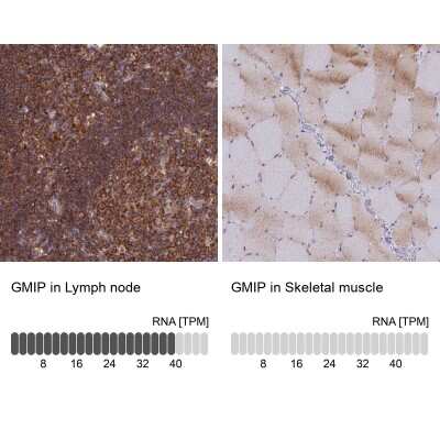 <b>Orthogonal Strategies Validation. </b>Immunohistochemistry-Paraffin: GEM Interacting Protein Antibody [NBP2-30537] - Staining in human lymph node and skeletal muscle tissues using anti-GMIP antibody. Corresponding GMIP RNA-seq data are presented for the same tissues.