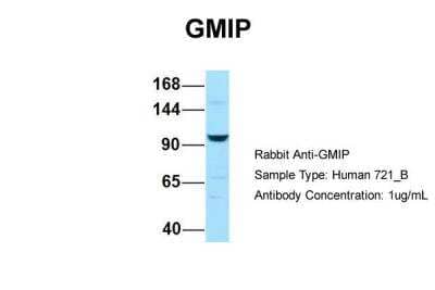 Western Blot: GEM Interacting Protein Antibody [NBP2-84967] - Host: Rabbit. Target Name: GMIP. Sample Type: Human 721_B. Antibody Dilution: 1.0ug/mlGMIP is supported by BioGPS gene expression data to be expressed in 721_B
