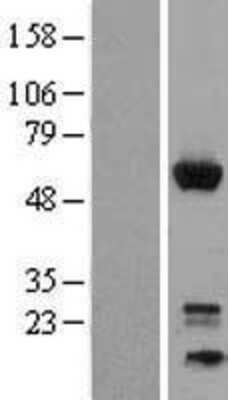 Western Blot: GEM Overexpression Lysate (Adult Normal) [NBP2-04282] Left-Empty vector transfected control cell lysate (HEK293 cell lysate); Right -Over-expression Lysate for GEM.