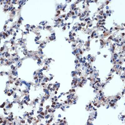 Immunohistochemistry-Paraffin: GEMIN2 Antibody (9C8K3) [NBP3-15717] - Immunohistochemistry of paraffin-embedded rat lung using GEMIN2 Rabbit mAb (NBP3-15717) at dilution of 1:100 (40x lens).Perform microwave antigen retrieval with 10 mM Tris/EDTA buffer pH 9.0 before commencing with IHC staining protocol.