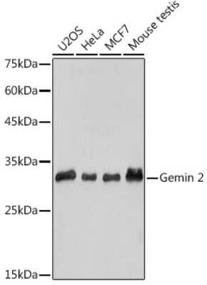 Western Blot GEMIN2 Antibody (9C8K3)