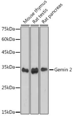 Western Blot: GEMIN2 Antibody (9C8K3) [NBP3-15717] - Western blot analysis of extracts of various cell lines, using GEMIN2 antibody (NBP3-15717) at 1:1000 dilution. Secondary antibody: HRP Goat Anti-Rabbit IgG (H+L) at 1:10000 dilution. Lysates/proteins: 25ug per lane. Blocking buffer: 3% nonfat dry milk in TBST. Detection: ECL Basic Kit. Exposure time: 60s.