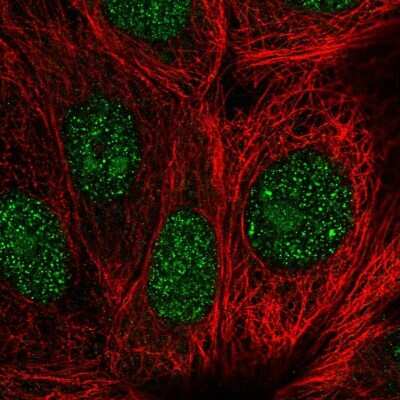 Immunocytochemistry/Immunofluorescence: GEMIN2 Antibody [NBP2-55393] - Staining of human cell line MCF7 shows localization to nucleus, nucleoli & nuclear bodies.