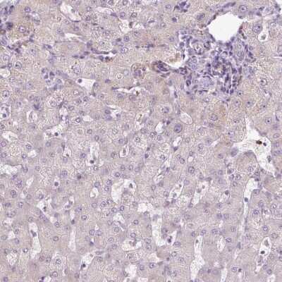 <b>Orthogonal Strategies Validation. </b>Immunohistochemistry-Paraffin: GEMIN2 Antibody [NBP2-38553] - Staining of human liver shows low expression as expected.