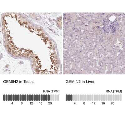 Immunohistochemistry-Paraffin: GEMIN2 Antibody [NBP2-38553] - Staining in human testis and liver tissues using anti-GEMIN2 antibody. Corresponding GEMIN2 RNA-seq data are presented for the same tissues.