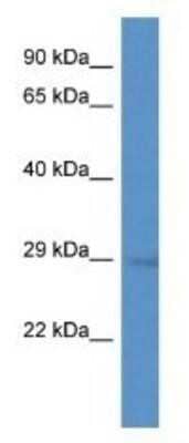 Western Blot: GEMIN2 Antibody [NBP1-80445] - Mouse Brain Lysate 1ug/ml Gel Concentration 12%