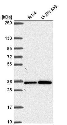 Western Blot: GEMIN2 Antibody [NBP2-55393] - Analysis in human cell line RT-4 and human cell line U-251 MG.