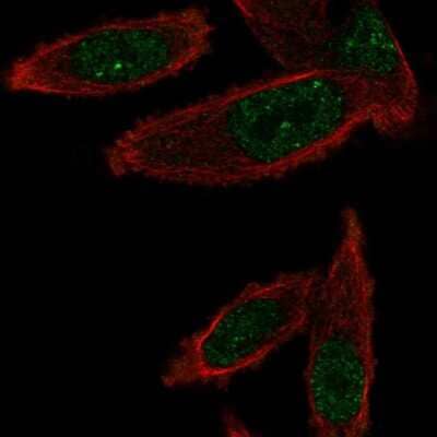 Immunocytochemistry/Immunofluorescence: GEMIN6 Antibody [NBP2-58682] - Staining of human cell line PC-3 shows localization to nucleoplasm & nuclear bodies.