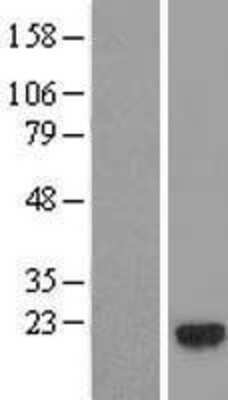 Western Blot: GEMIN6 Overexpression Lysate (Adult Normal) [NBL1-11038] Left-Empty vector transfected control cell lysate (HEK293 cell lysate); Right -Over-expression Lysate for GEMIN6.